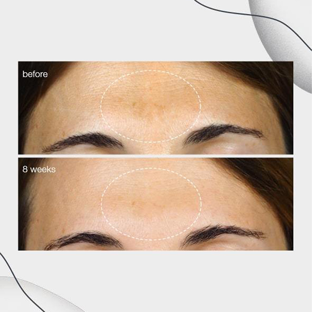 Powerbright Dark Spot Serum Powerbright Dark Spot Serum