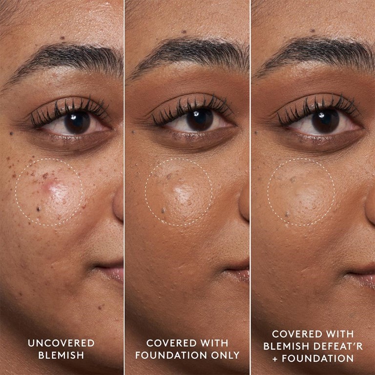 Blemish Defeat’r BHA Spot-Targeting Gel