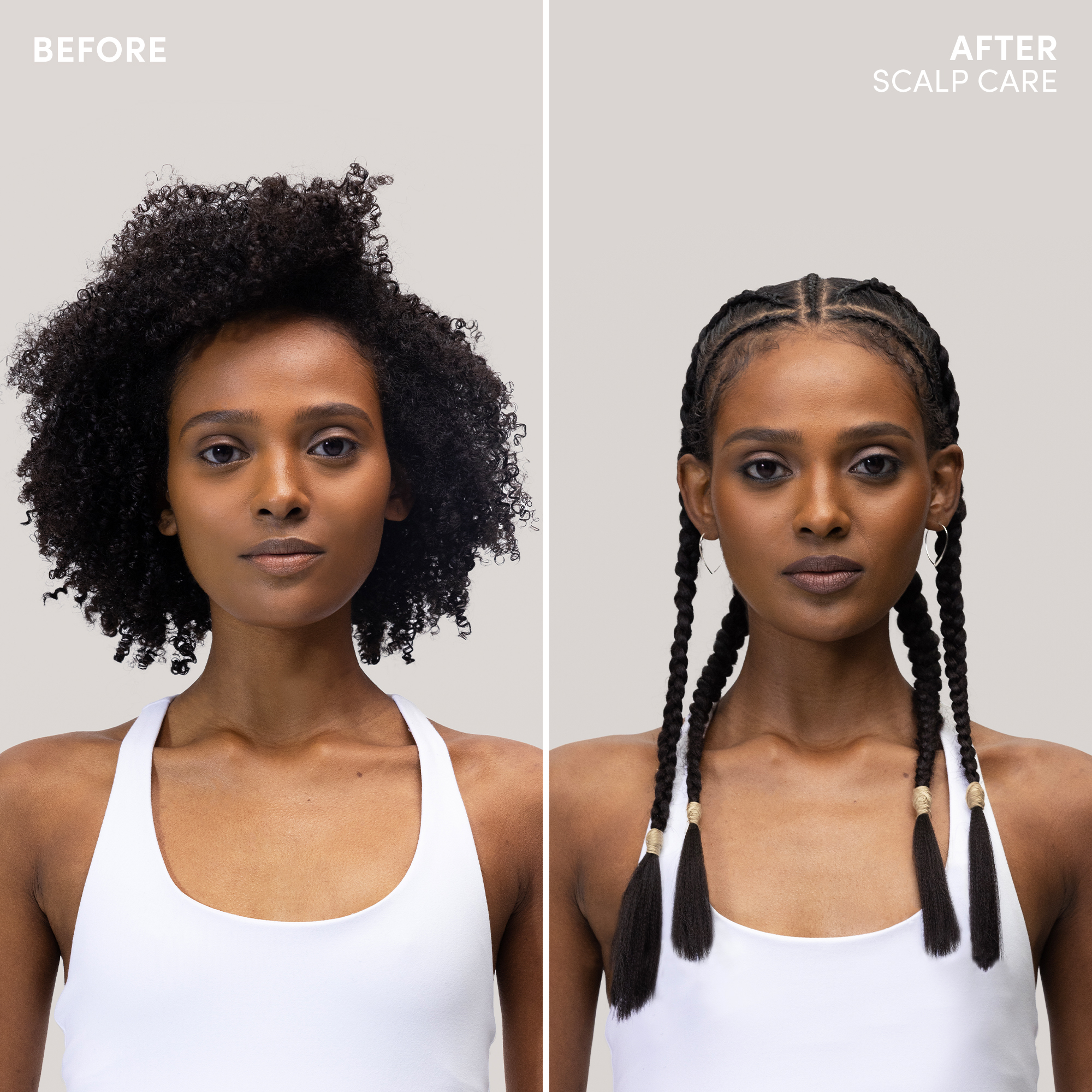 Scalp Calming Lotion